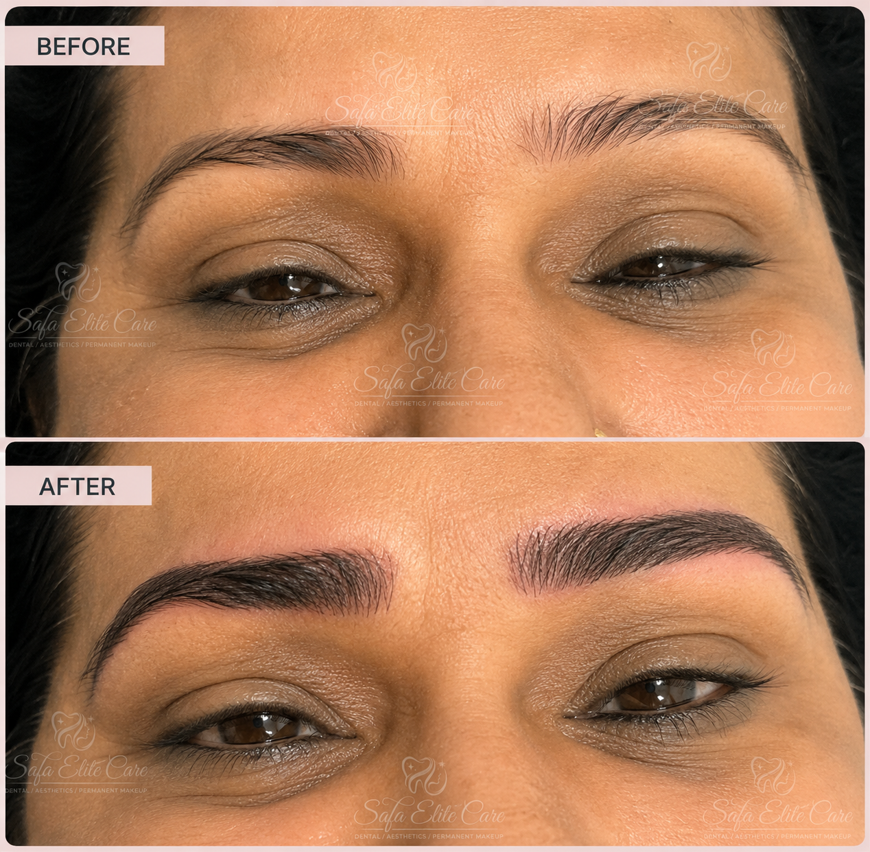 Eyebrow Microblading Before & After Case 1